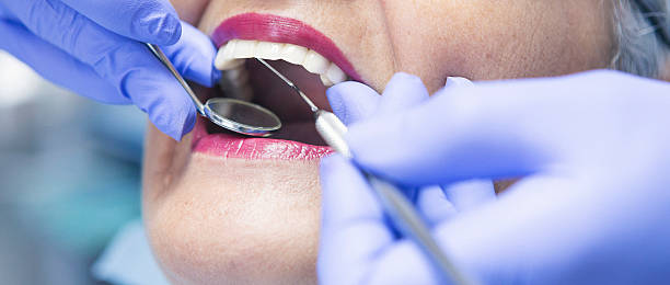 Best Emergency Treatment for Toothache in Souderton, PA